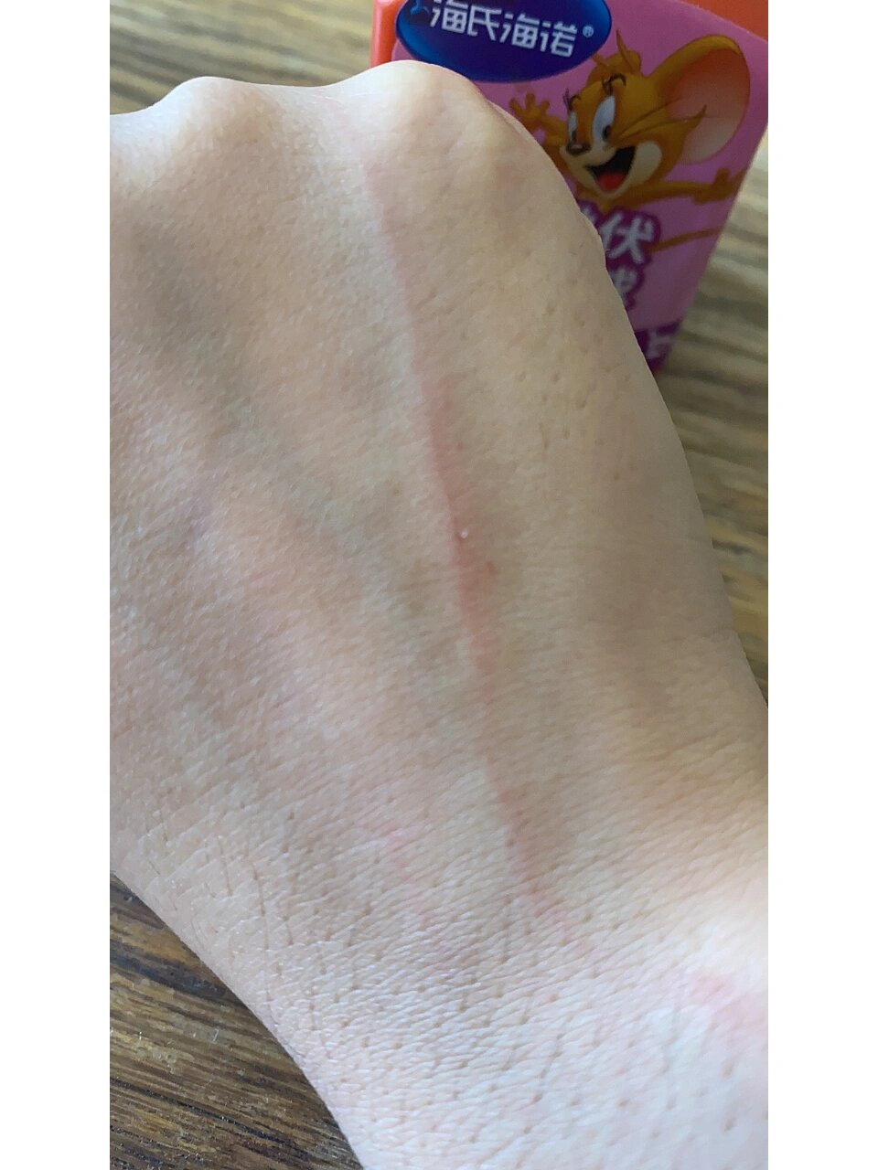 被五个月的家养泰迪抓伤