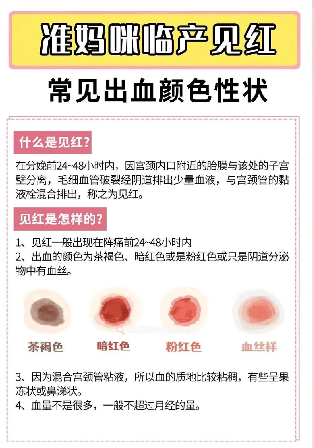 临产见红,宫缩,破水后多久会生6315孕妈必看