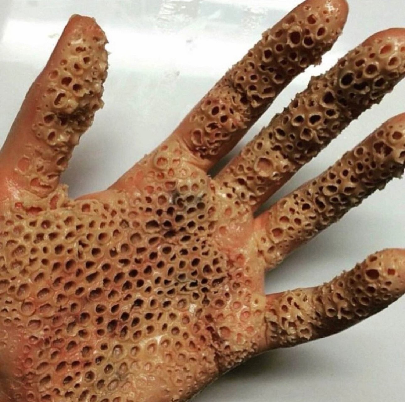 密集恐惧症恐怖图片,胆小勿进 密集#恐怖