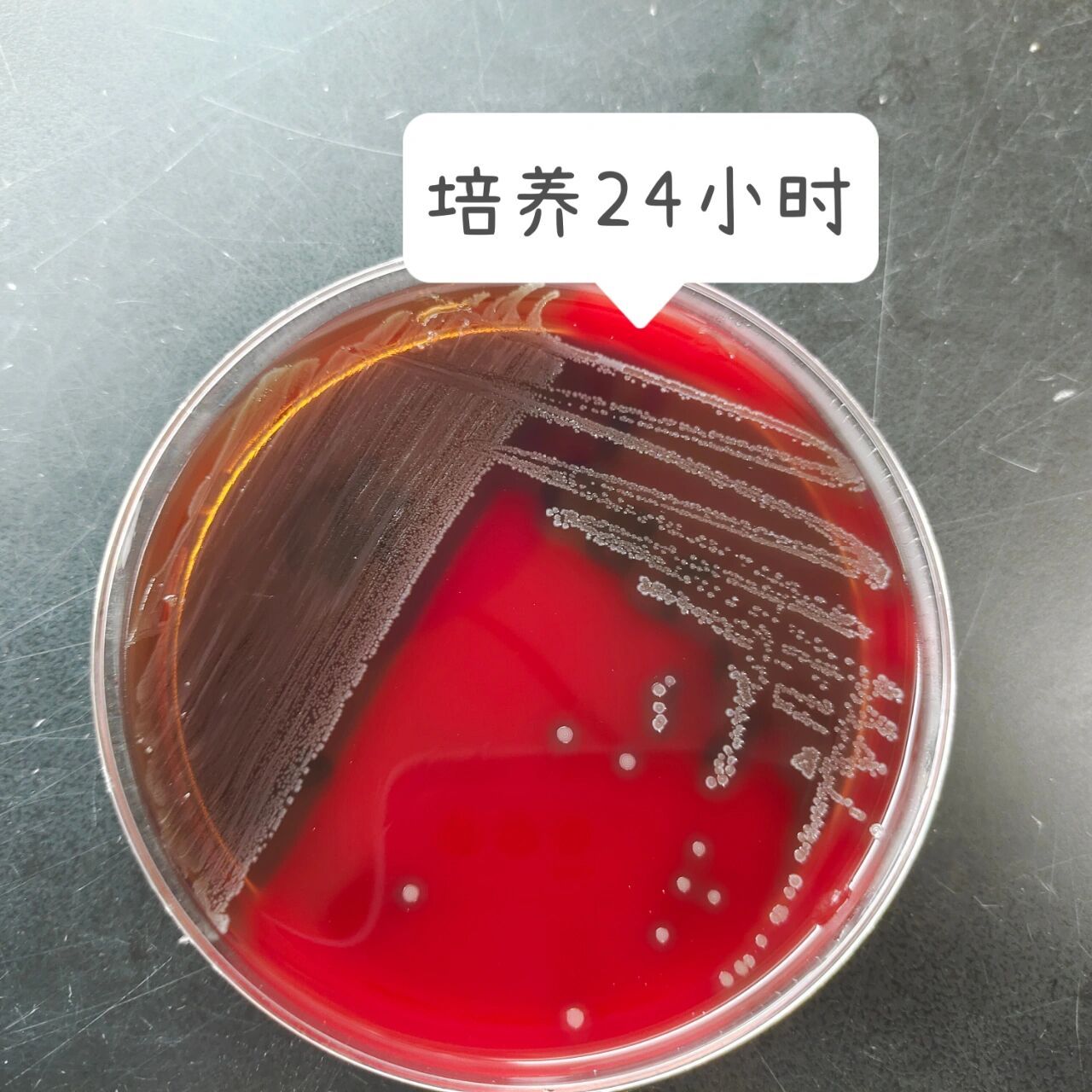 化脓性链球菌图片