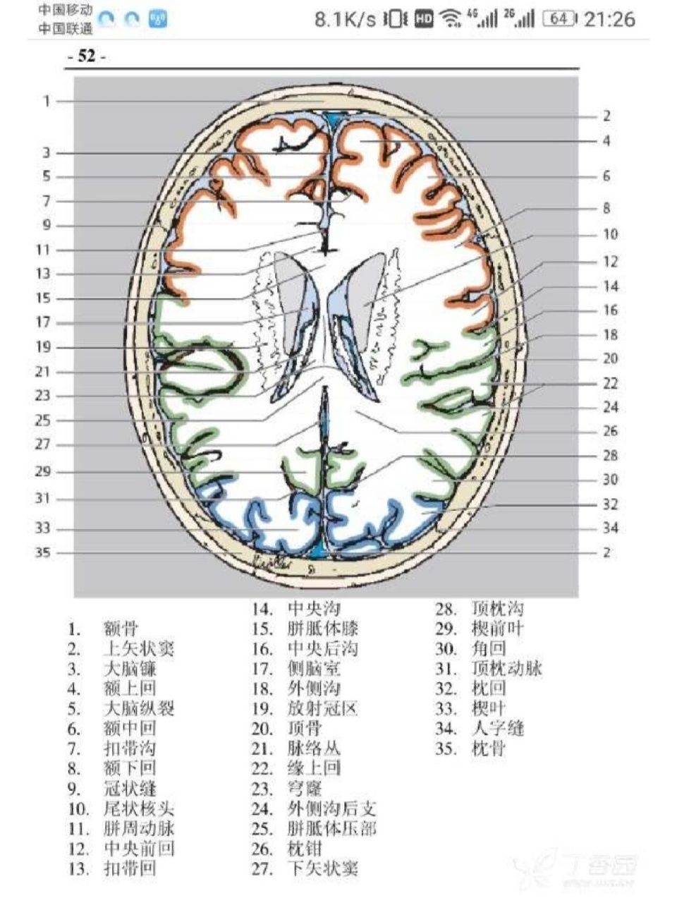 头部横断层解剖图图片