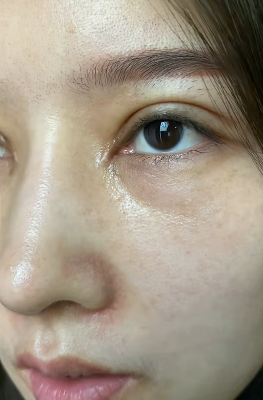 眼角 增生了,不想用凝胶,买的舒尔丹家增生贴,可以剪任意大小,睡觉前