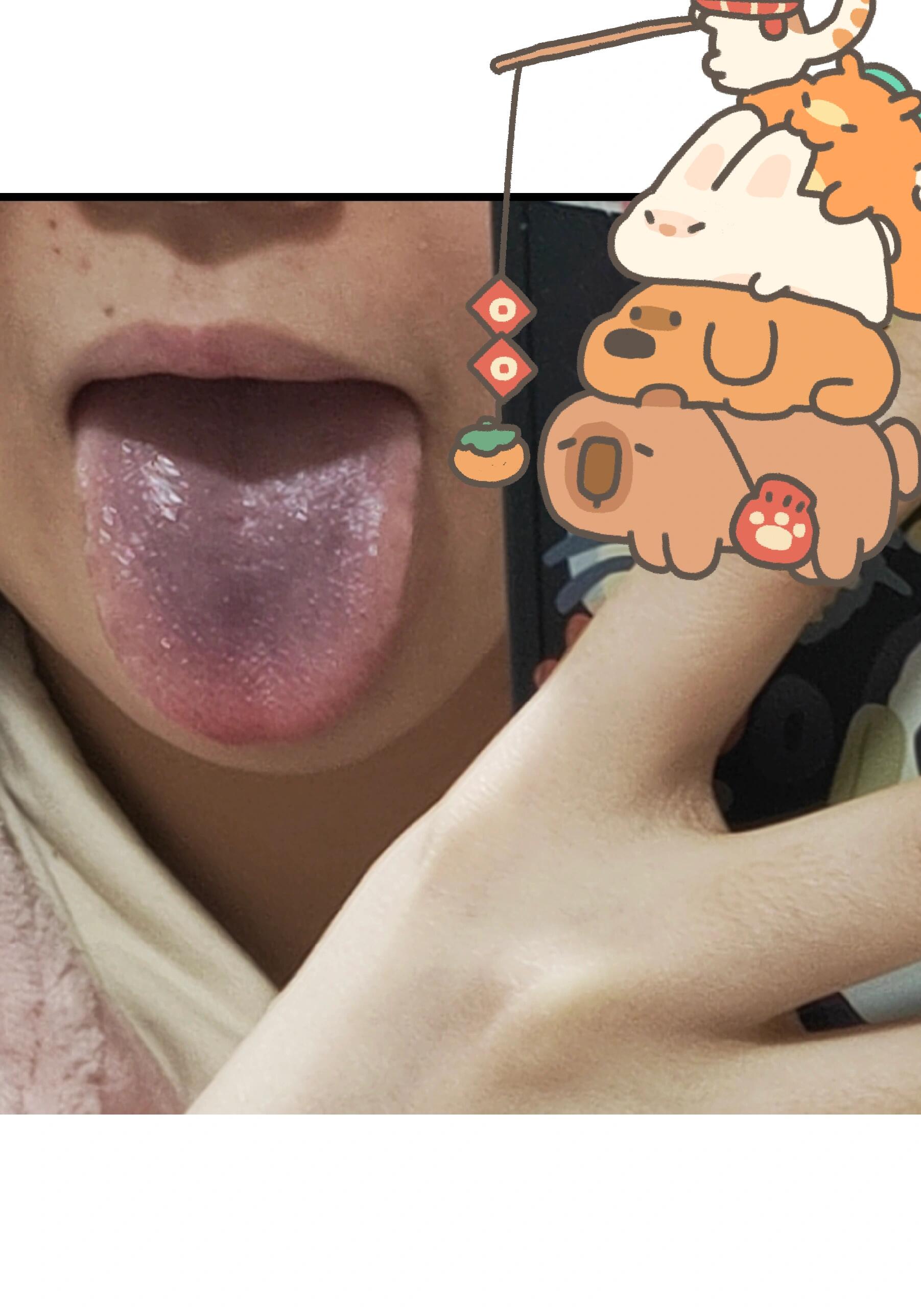 吃完早饭发现舌头发紫