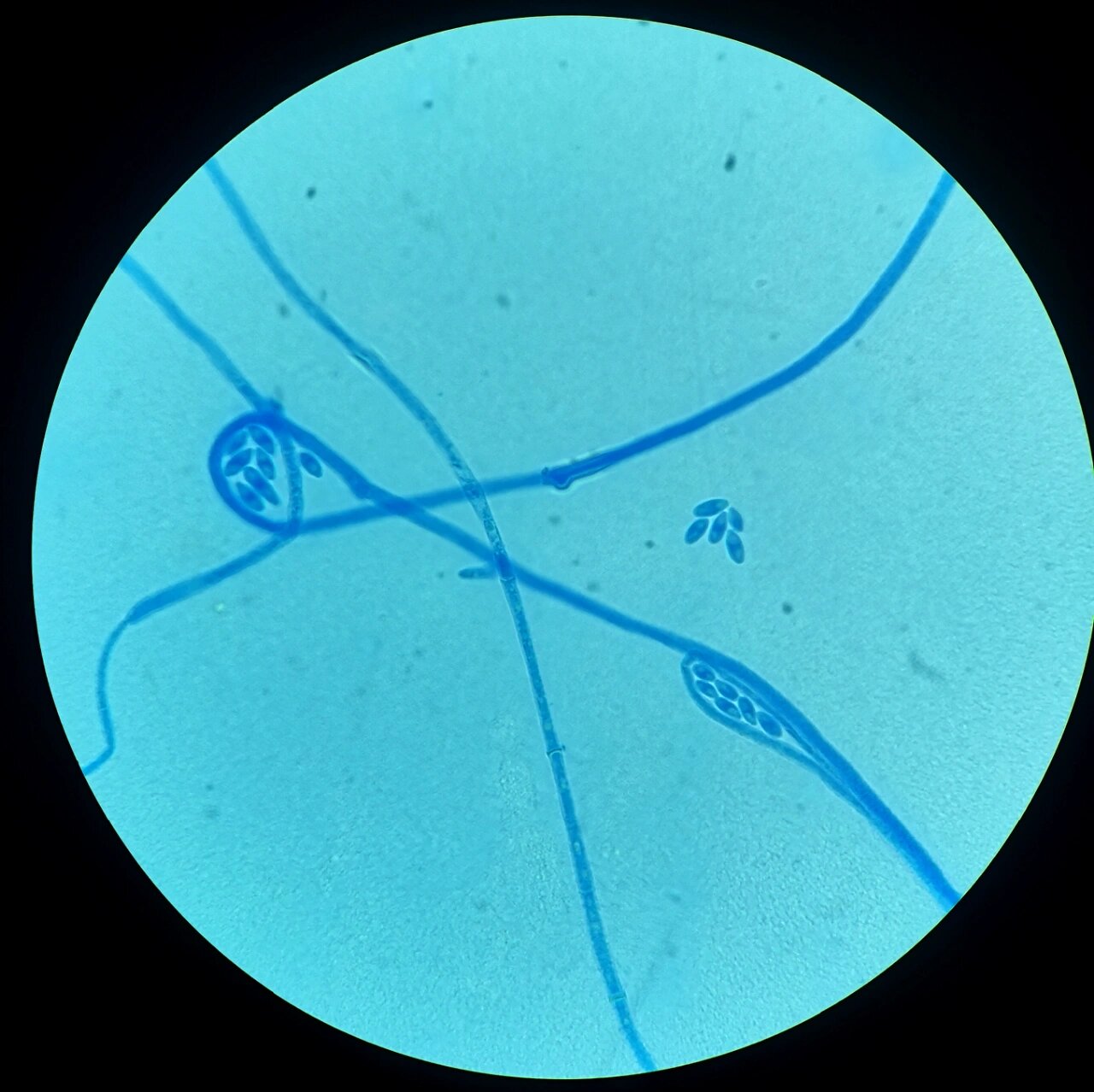 镰刀菌→棉兰染色×1000