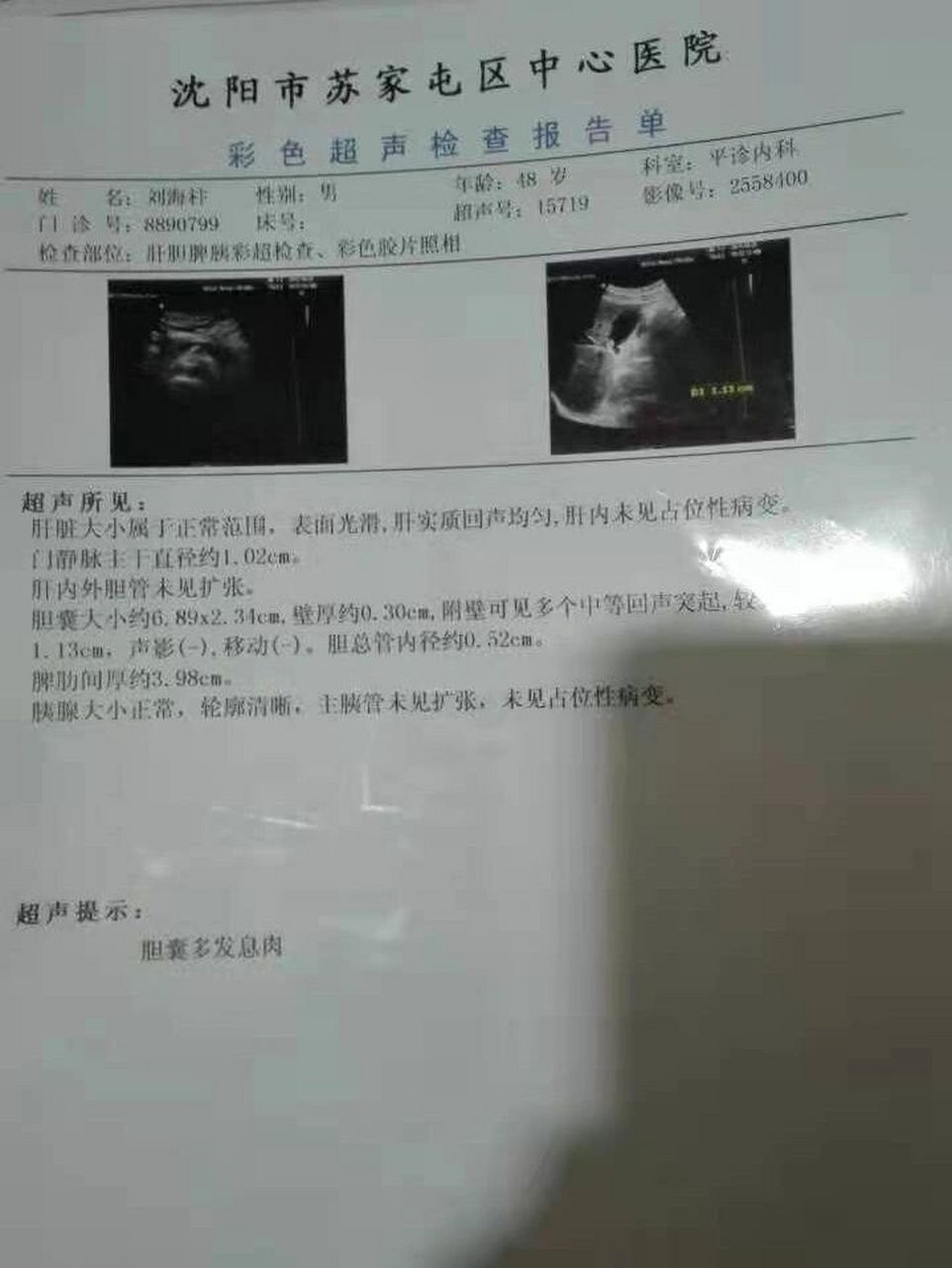 在沈阳工作,突然有面黄,恶心,呕吐的症状,彩超发现多发性胆囊息肉,最