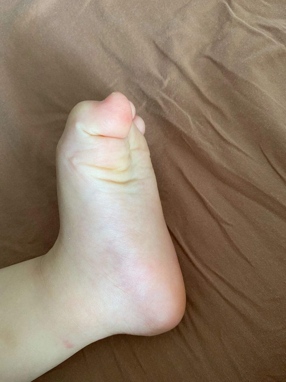 这样子是扁平足吗 小宝宝有足弓吗 我儿子脚好像没什么足弓哎 踩地上