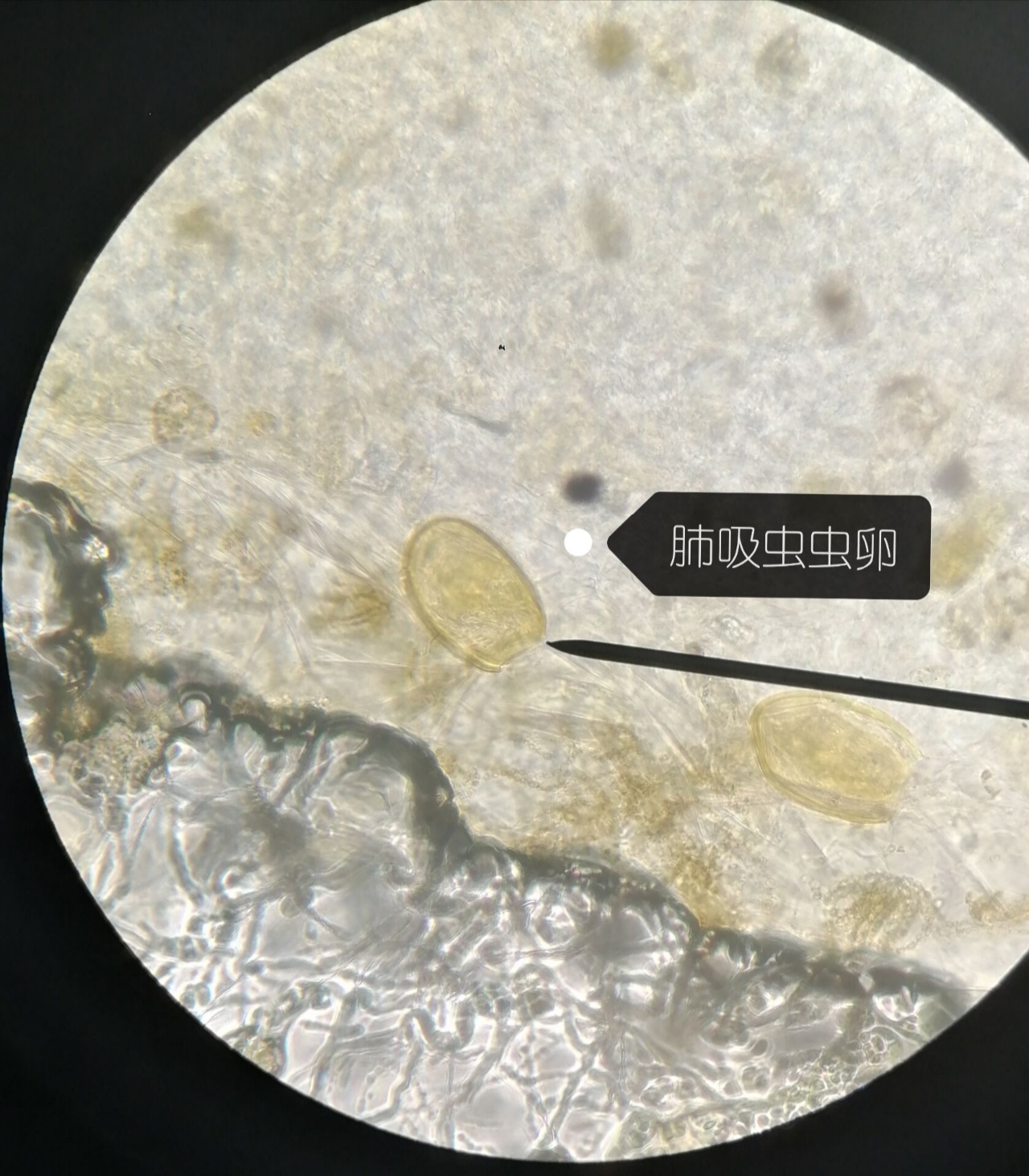 显微镜下各种寄生虫虫卵.夏天到了,大家记得少吃生食,饭前勤洗手.