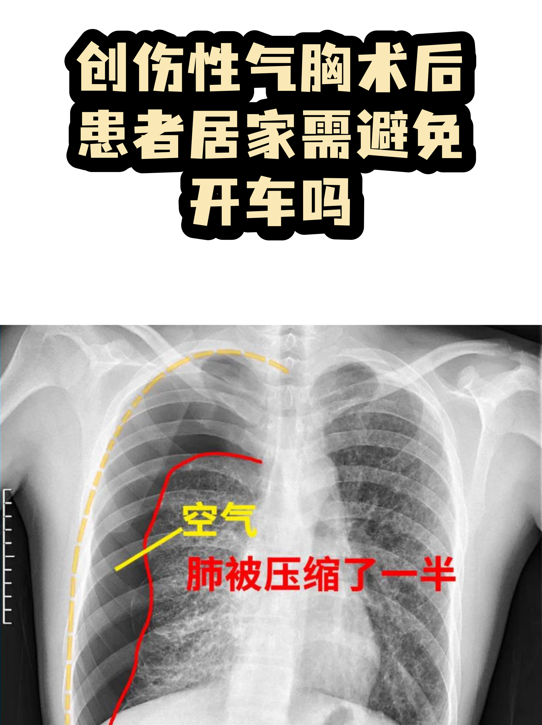 原火箭军总医院代挂专家号加代问诊出院后康复提醒，居家恢复更科学的简单介绍