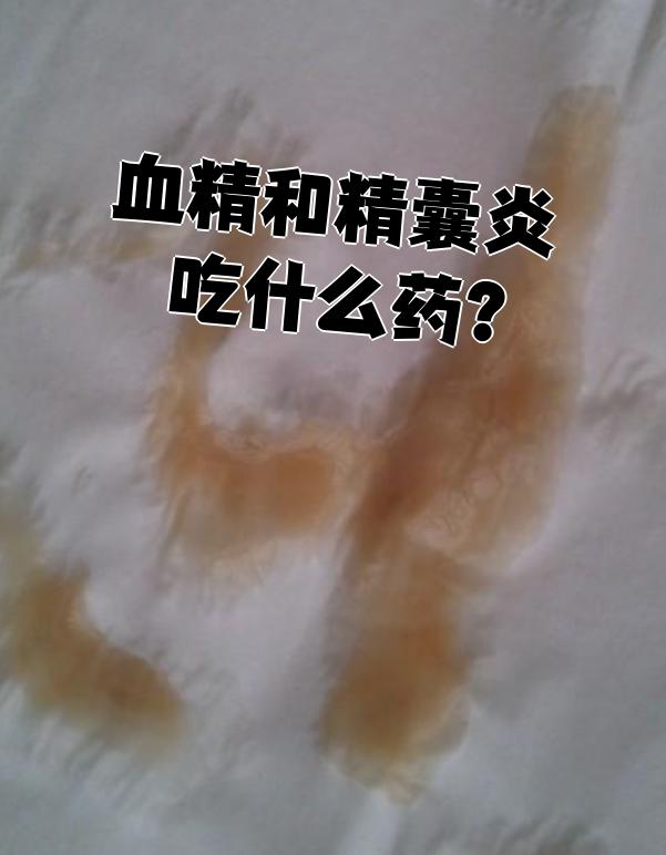 血精最常见的原因是精囊炎