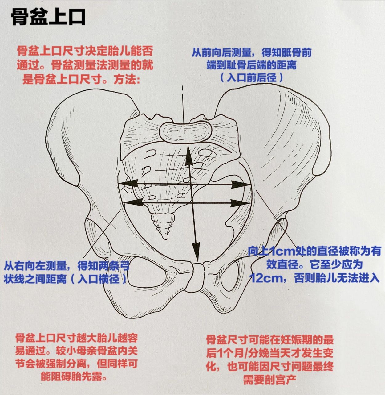 骨盆下口图片图片