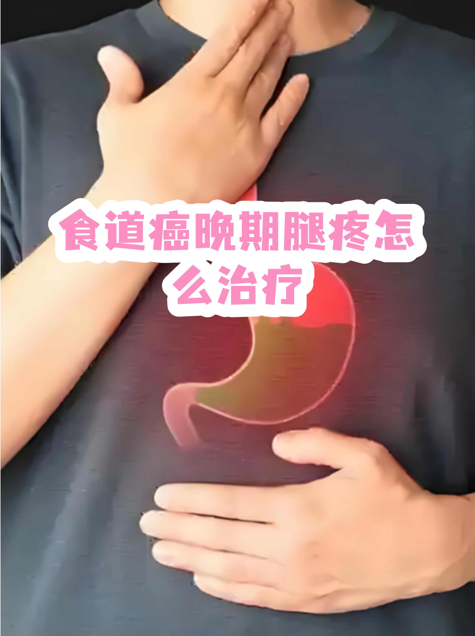 天壇醫(yī)院檢查陪護(hù)加掛號(hào)復(fù)雜病情綜合分析，治療方向更明確的簡(jiǎn)單介紹