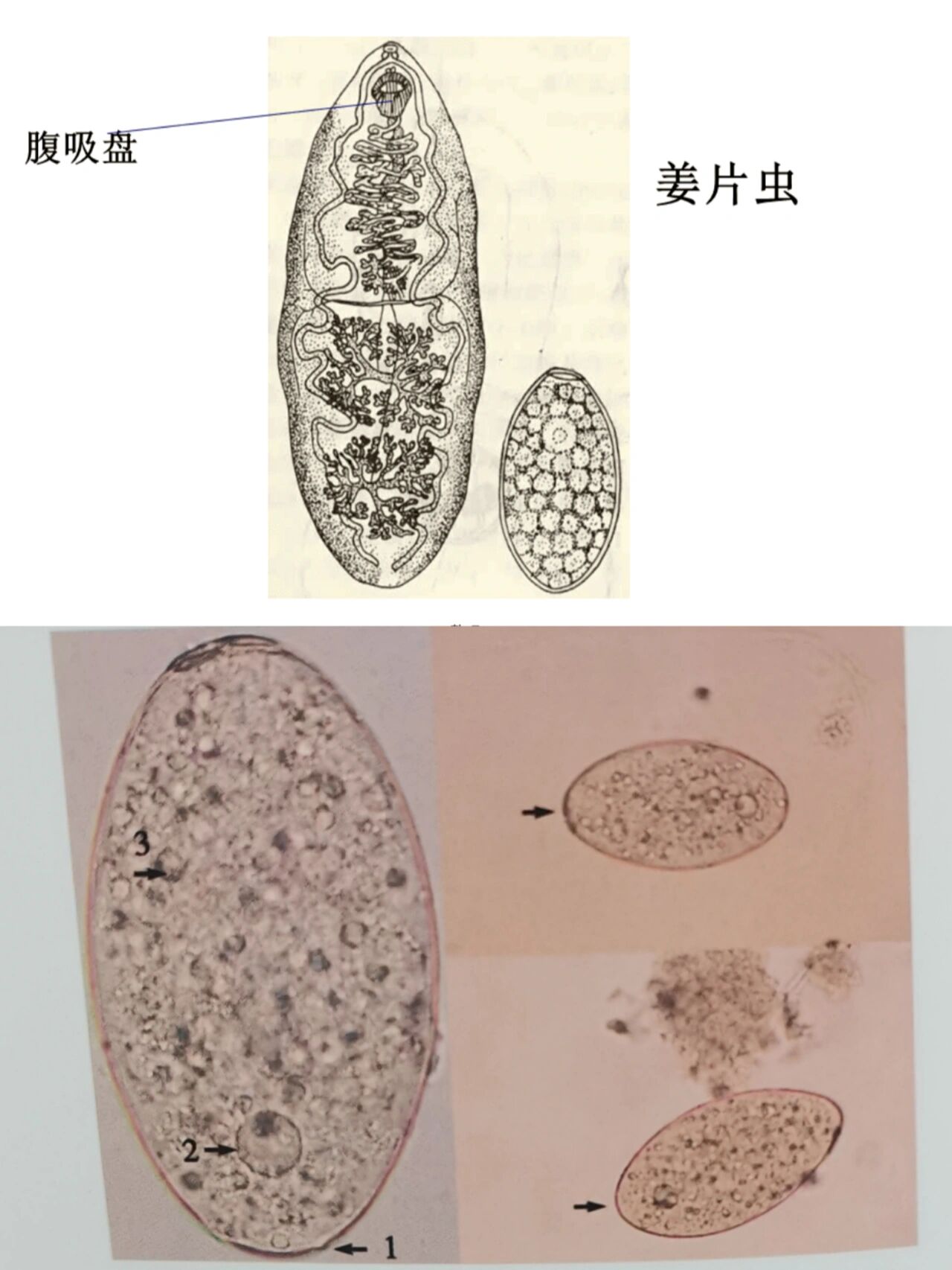 识别粪便里几种寄生虫的形态学73