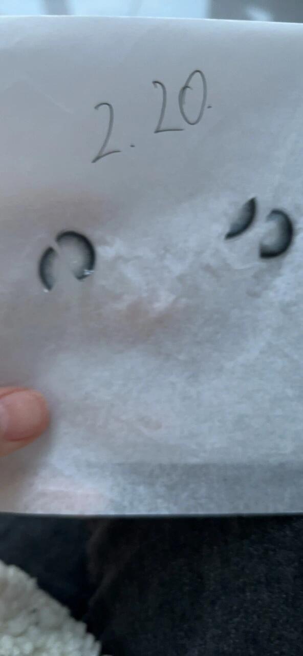 拉拜诗 今天刚到的美瞳,刚带了一下就放盒里泡起来了,在看就碎了,商家