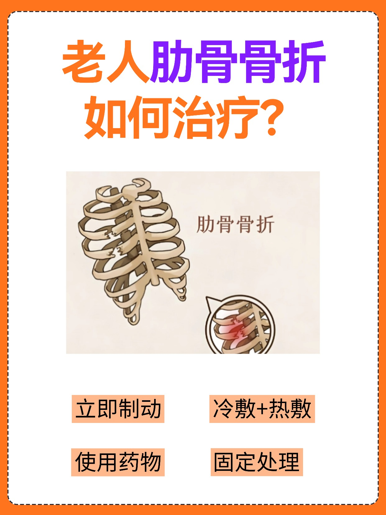 骶4椎体骨折可以站着吗 				