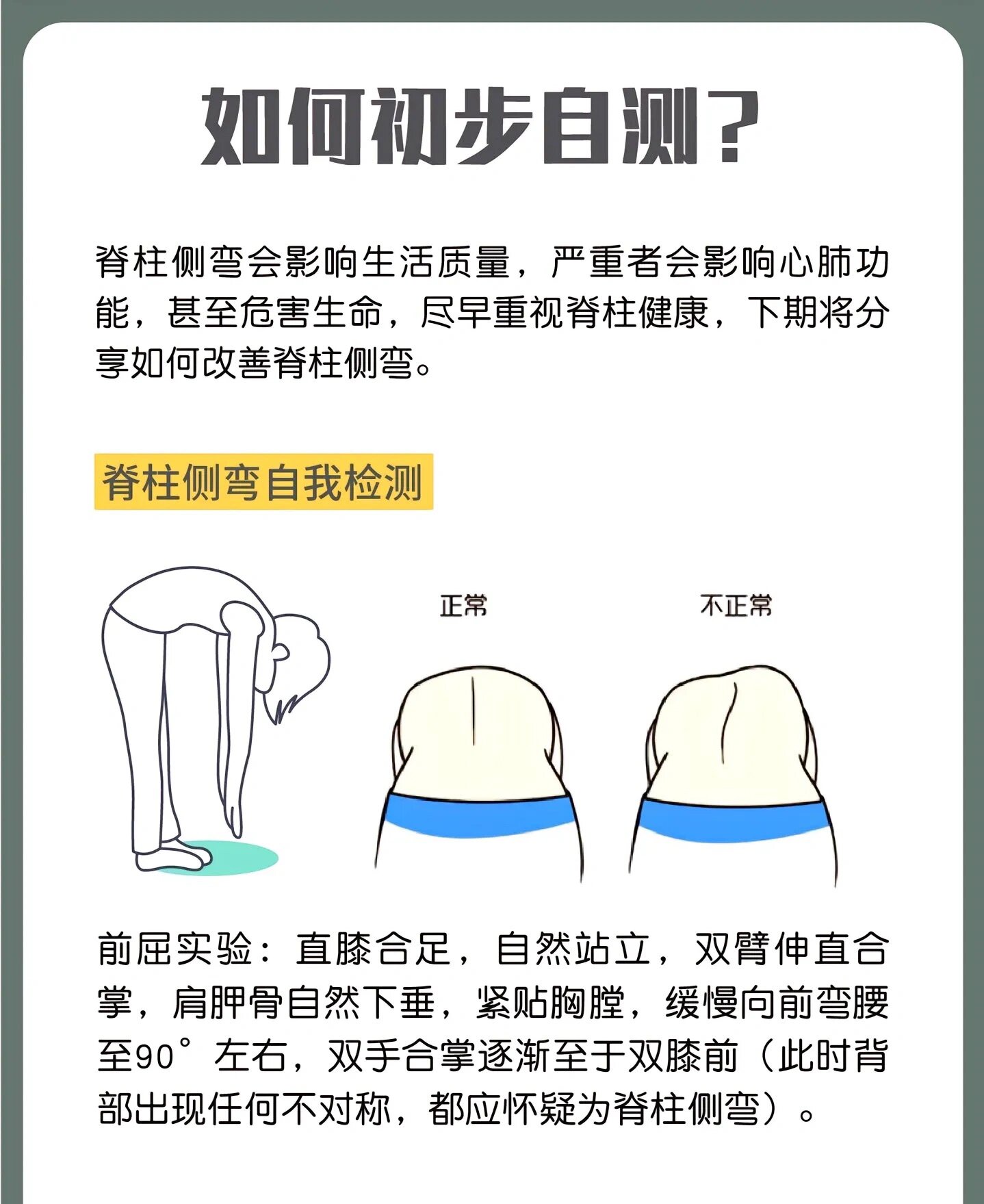 脊柱侧弯怎么看出来图片