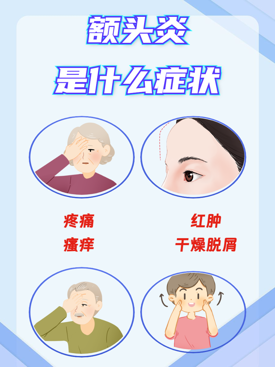 为什么额头疼