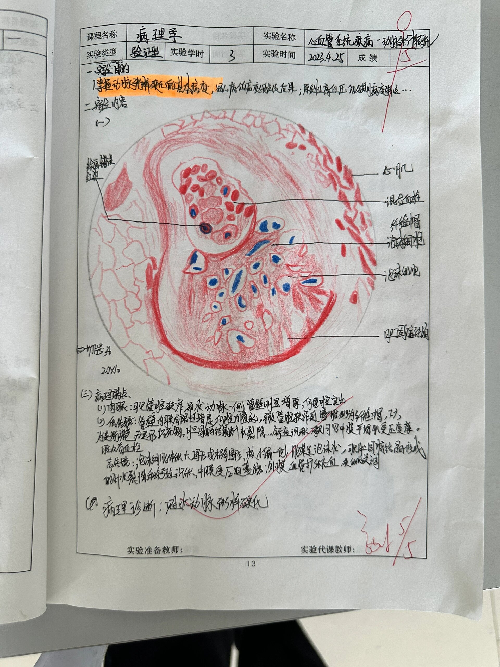 病理红蓝铅笔绘图