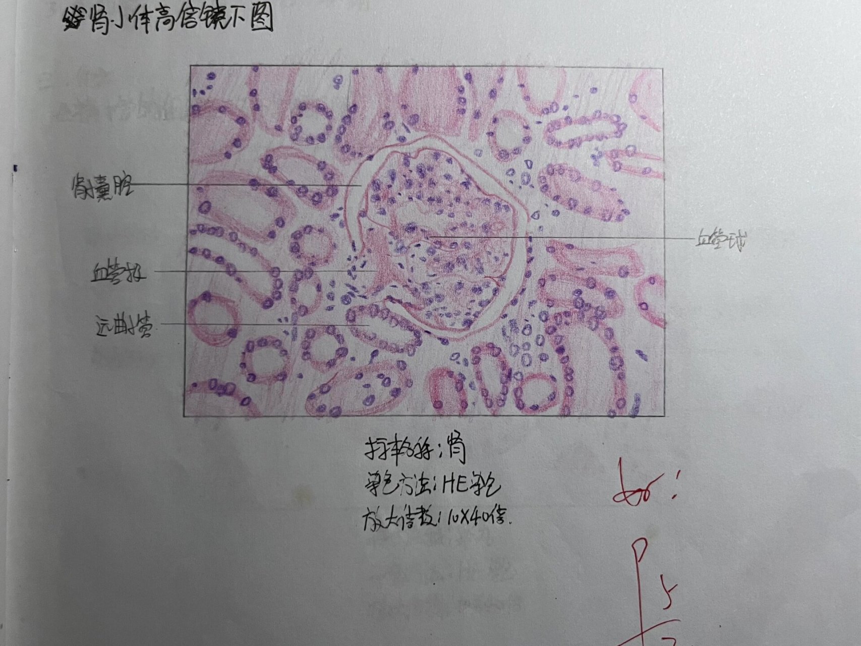 要结课了发一下,比较贴合实际不太算红蓝铅笔( p2 单层立方上皮 p3 中