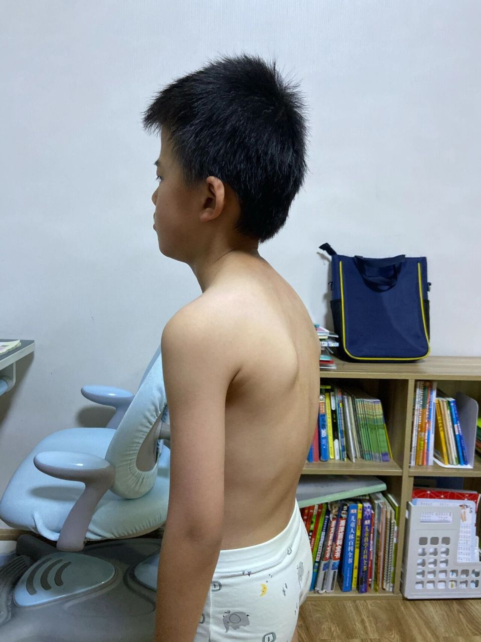 8周岁男孩驼背的自我矫正
