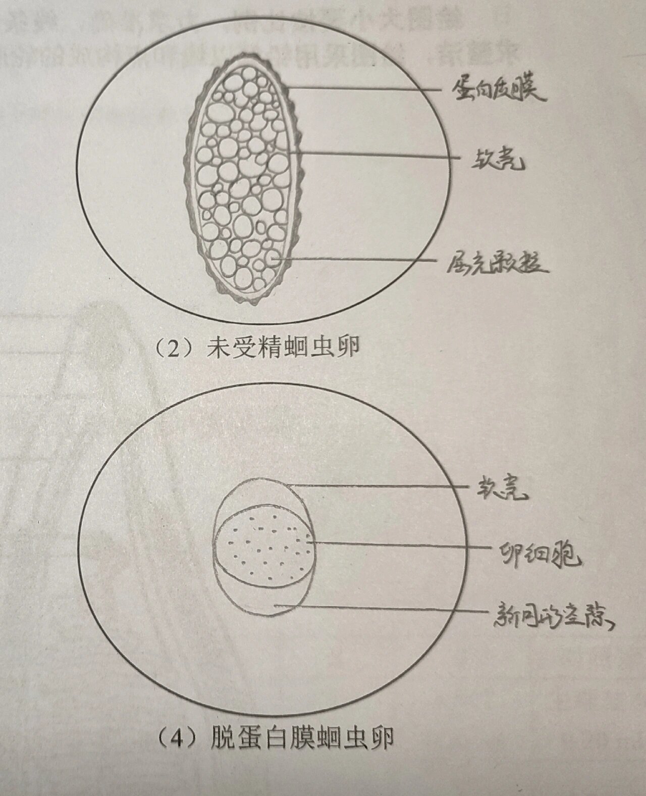 鞭虫卵手绘图及名称图片