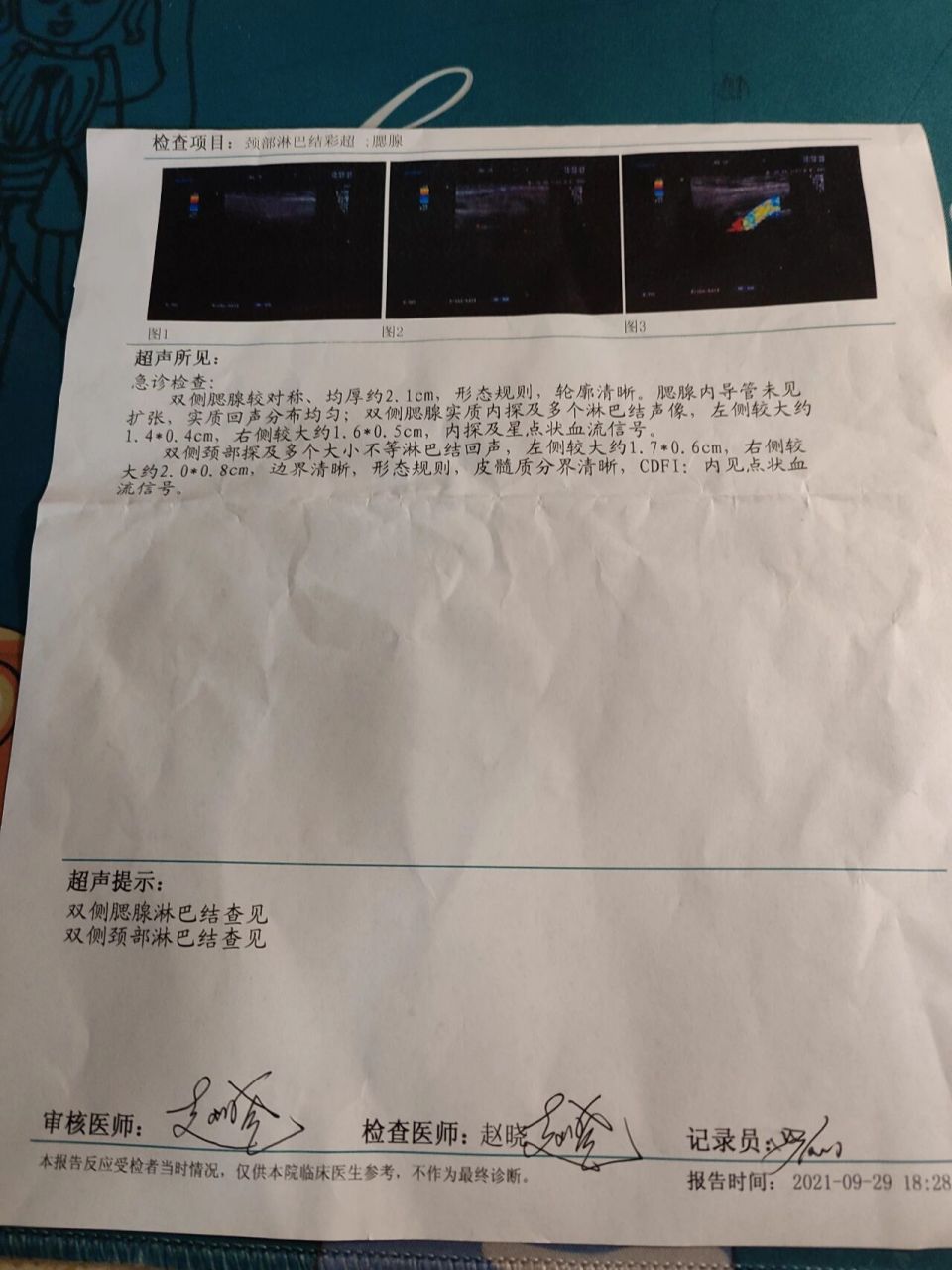 淋巴结肿大,但不疼不痒,有三个多月了 腮腺内导管未见 双侧腮腺较对称