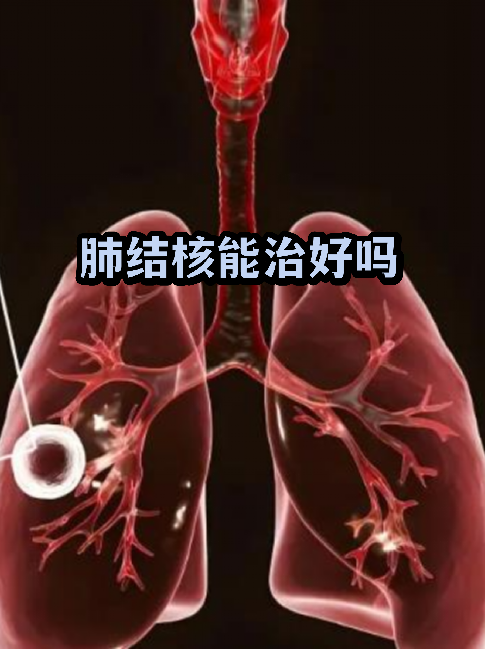  疫情这是什么病(这次疫情叫什么病毒有什么症状)