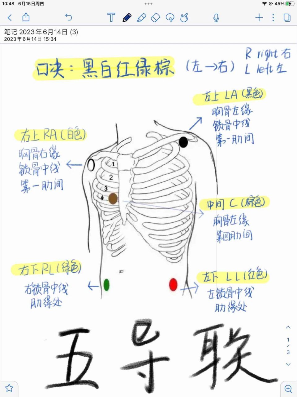 胸导联v1到v6的位置图片