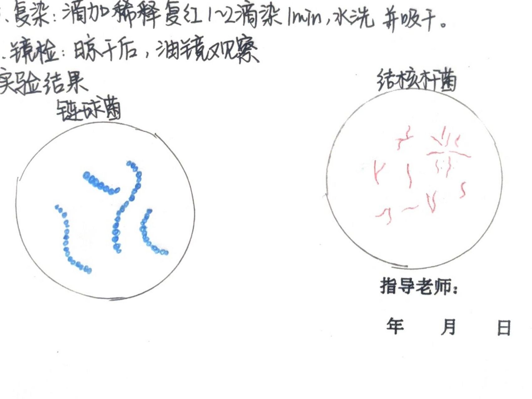 微生物实验报告 金黄色葡萄球菌 肺炎链球菌 脑膜炎奈瑟菌 淋病奈瑟菌