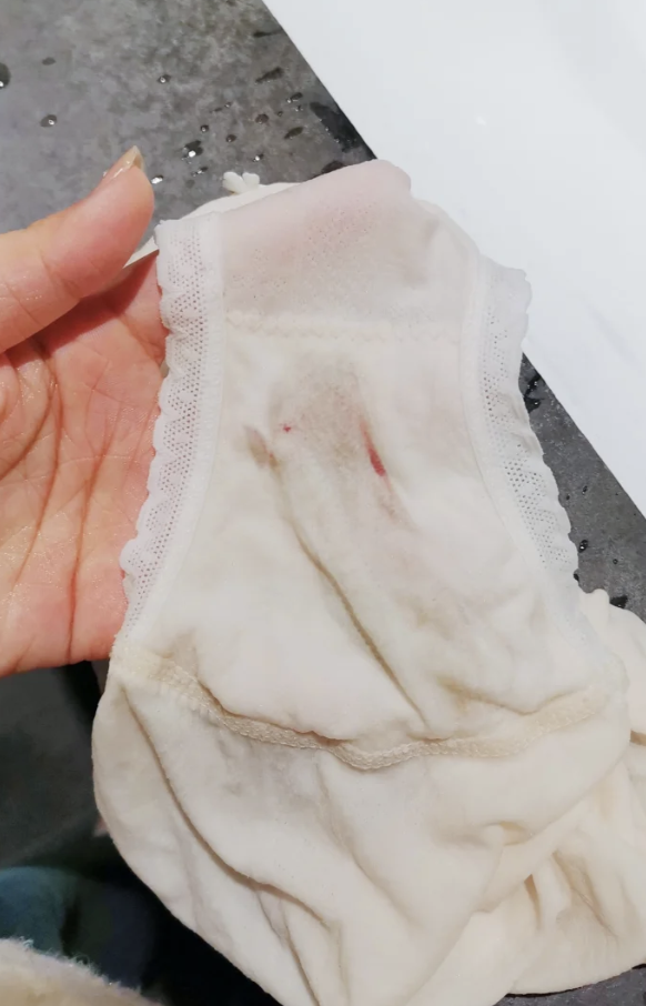 做完白带检查后出血确实不太常见,但也不用太紧张