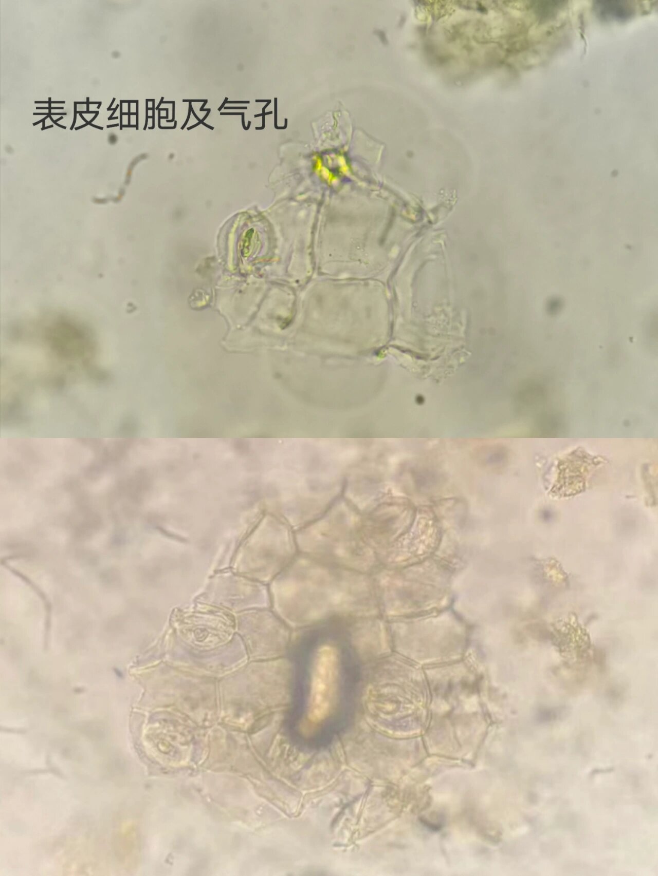 番泻叶粉末显微特征图 ·非腺毛--单细胞,壁厚,基部弯曲,具疣状凸起