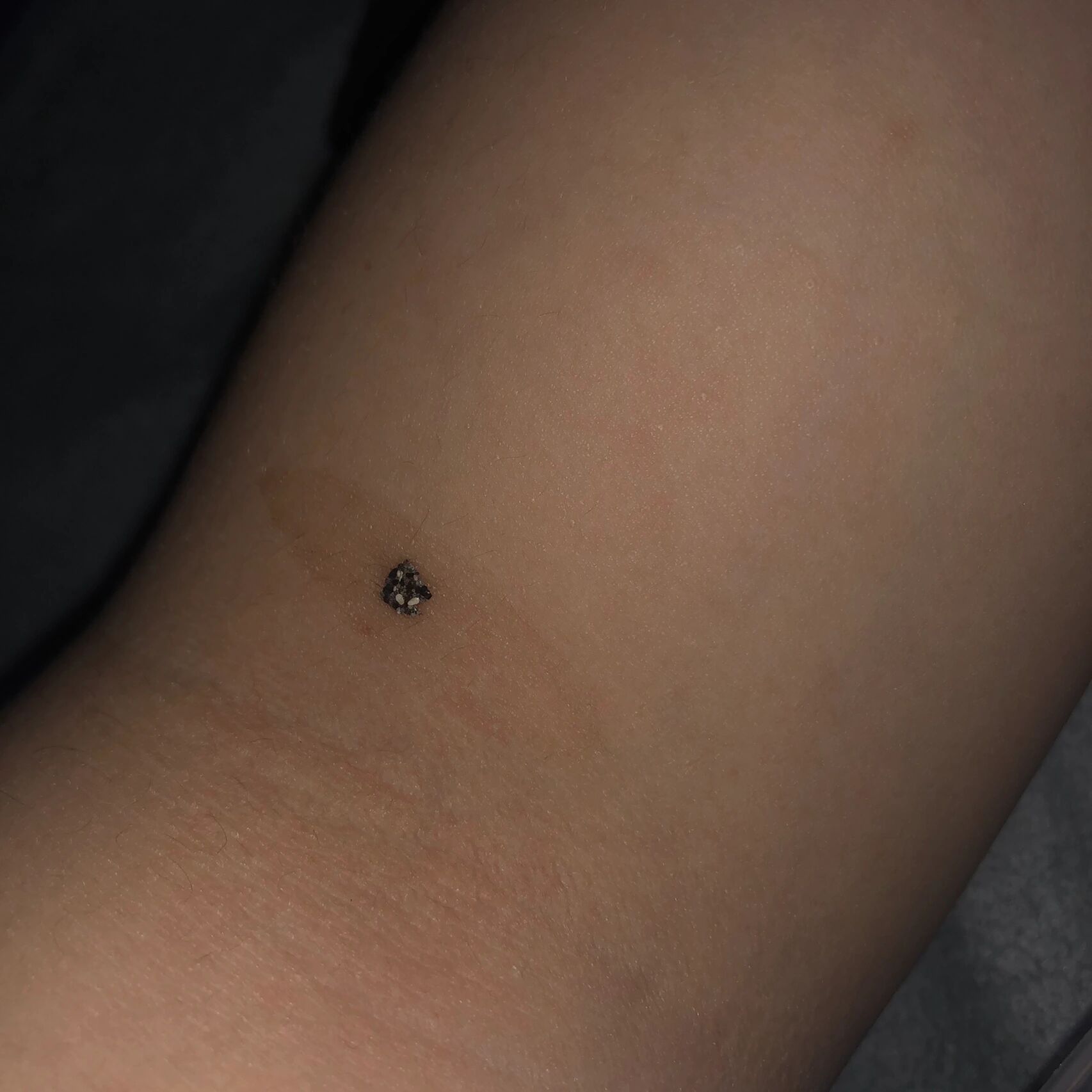 原来蜘蛛的屎是这样的!