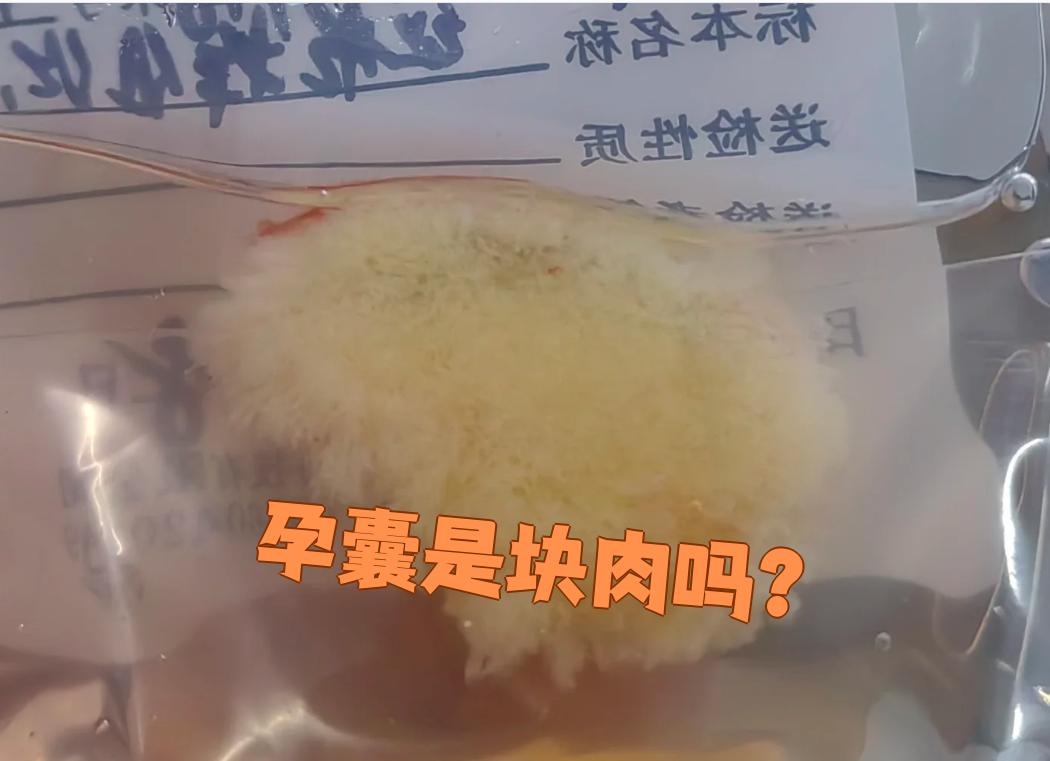 孕囊不是肉,它是怀孕早期的结构