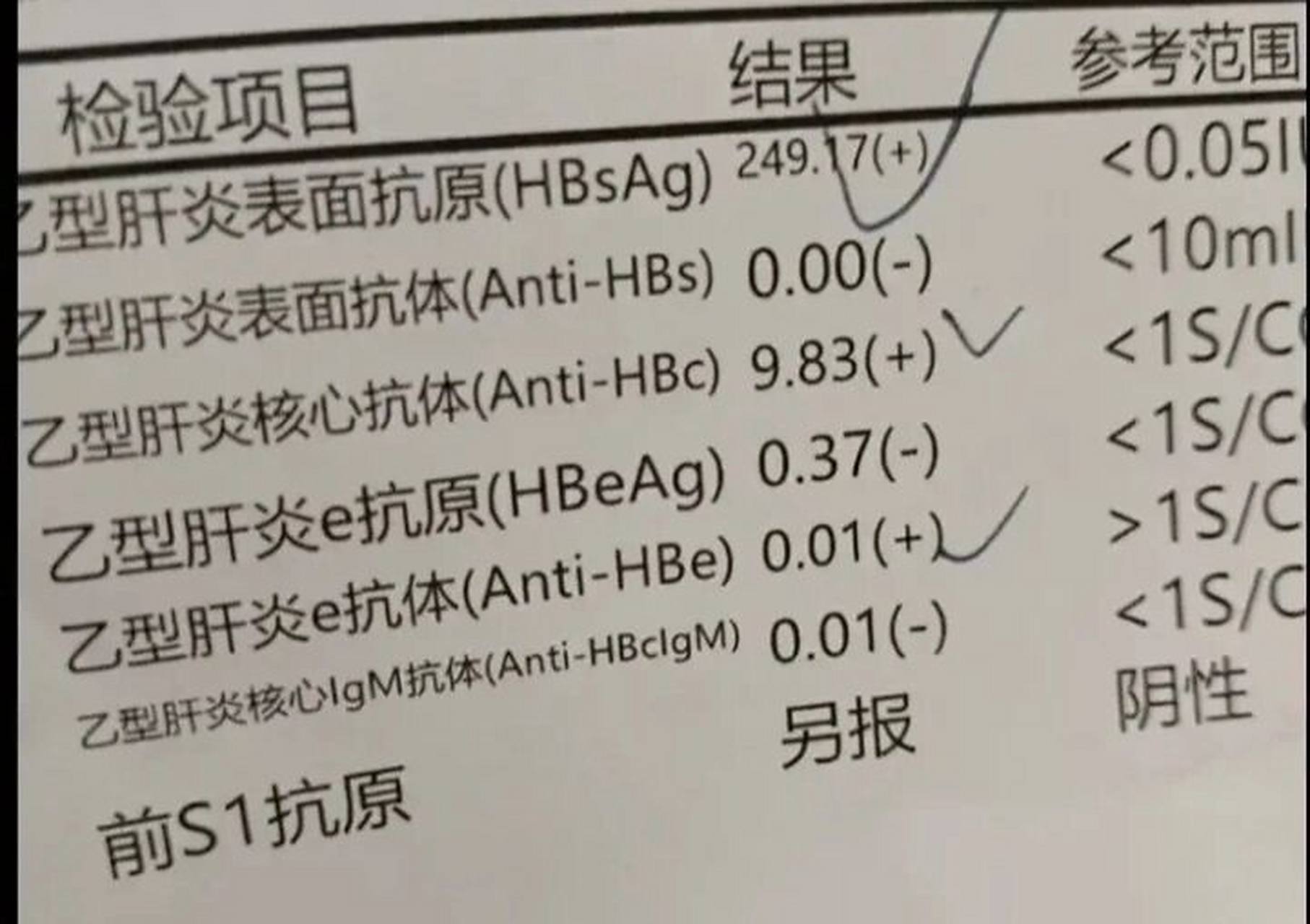 这是张乙肝两对半的检查报告单,有的叫乙肝五项或者乙肝六项,因为有