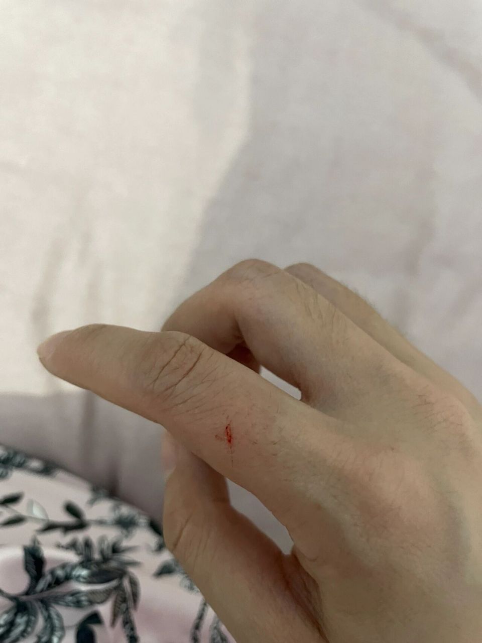 被自家狗狗指甲划伤流血,需要打疫苗么 有知道的么?