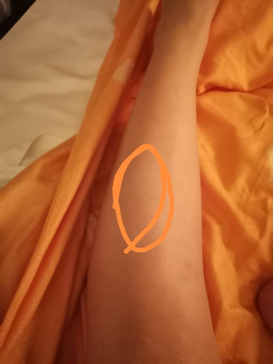 小腿前侧疼是为什么 小腿的前侧这块疼是因为什么啊?