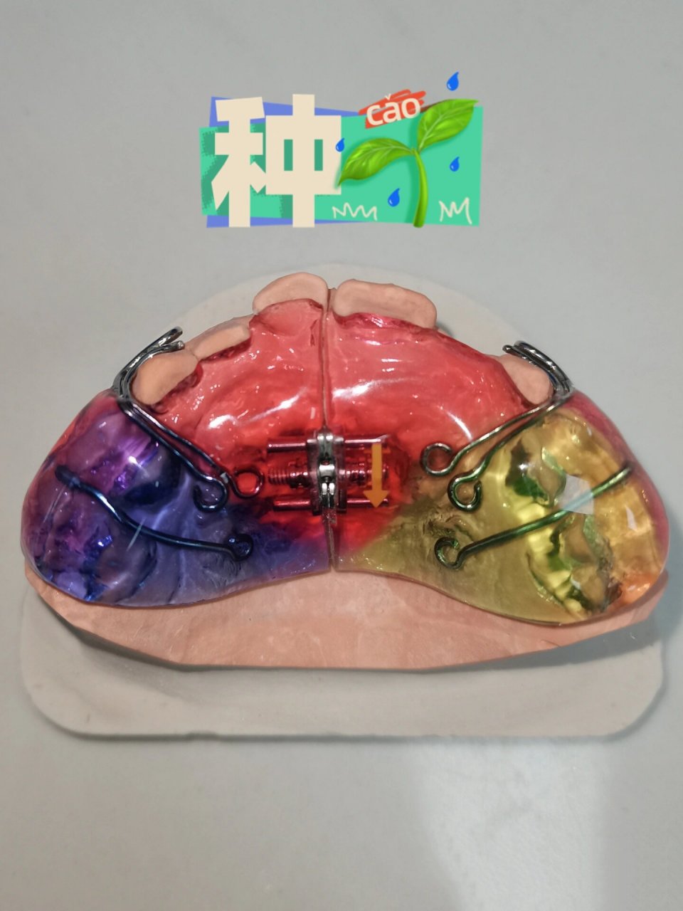 前方牵引器的佩戴注意事项6015 1.