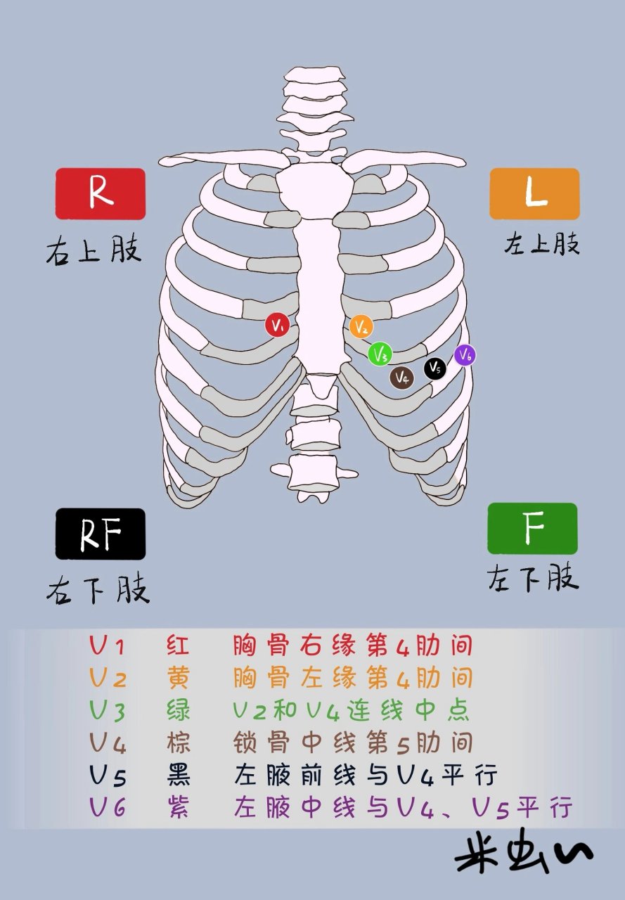 心电图导联的位置颜色图片