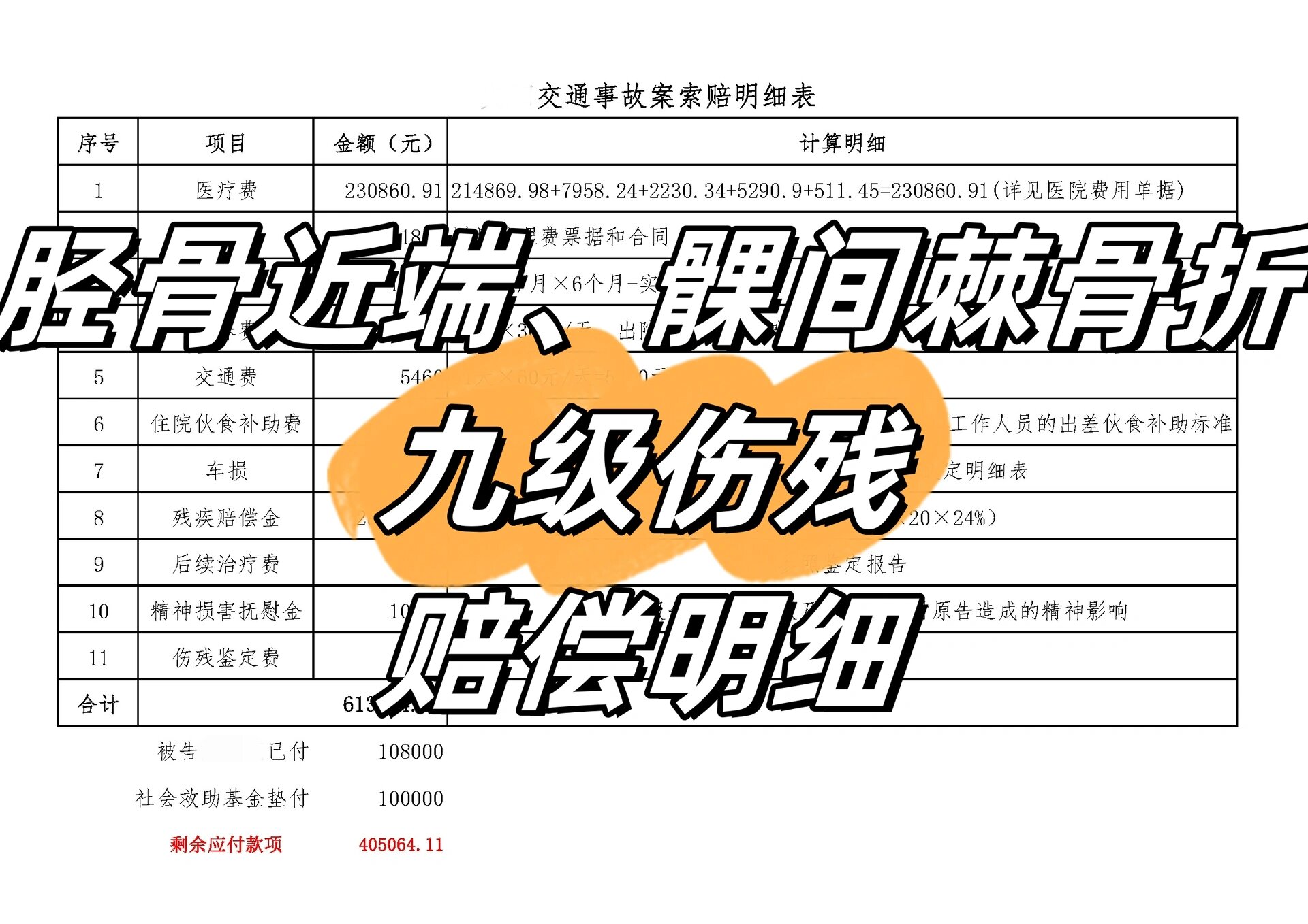 意外死亡的赔偿明细表