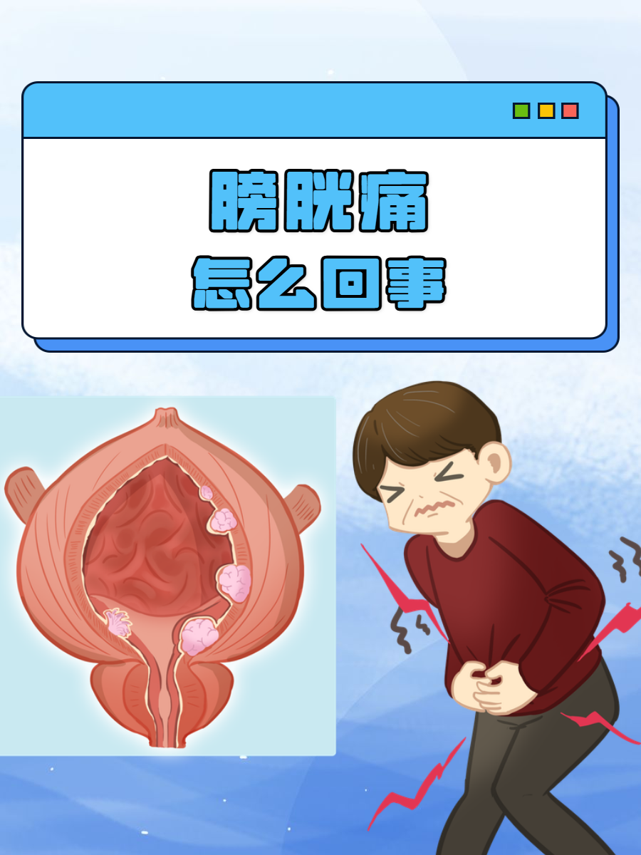 在日常生活中,我们偶尔会遭遇膀胱痛的困扰,这种突如其