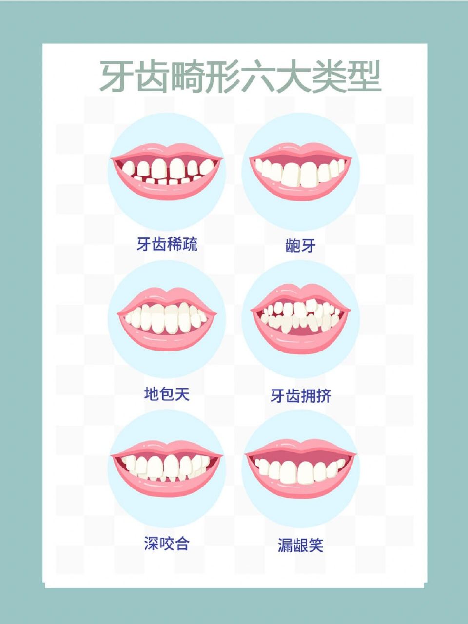 一张图带你了解你的牙齿 牙齿畸形六大类型 牙齿稀疏 龅牙 地包天