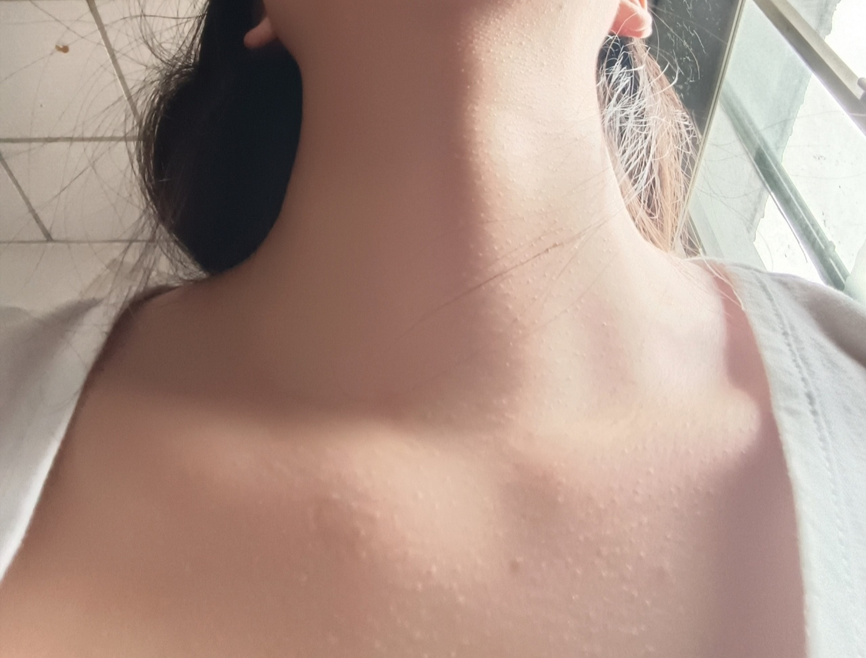 脖子上小白点点 求助,有没有姐妹知道脖子上的小白点点是啥玩意儿啊?