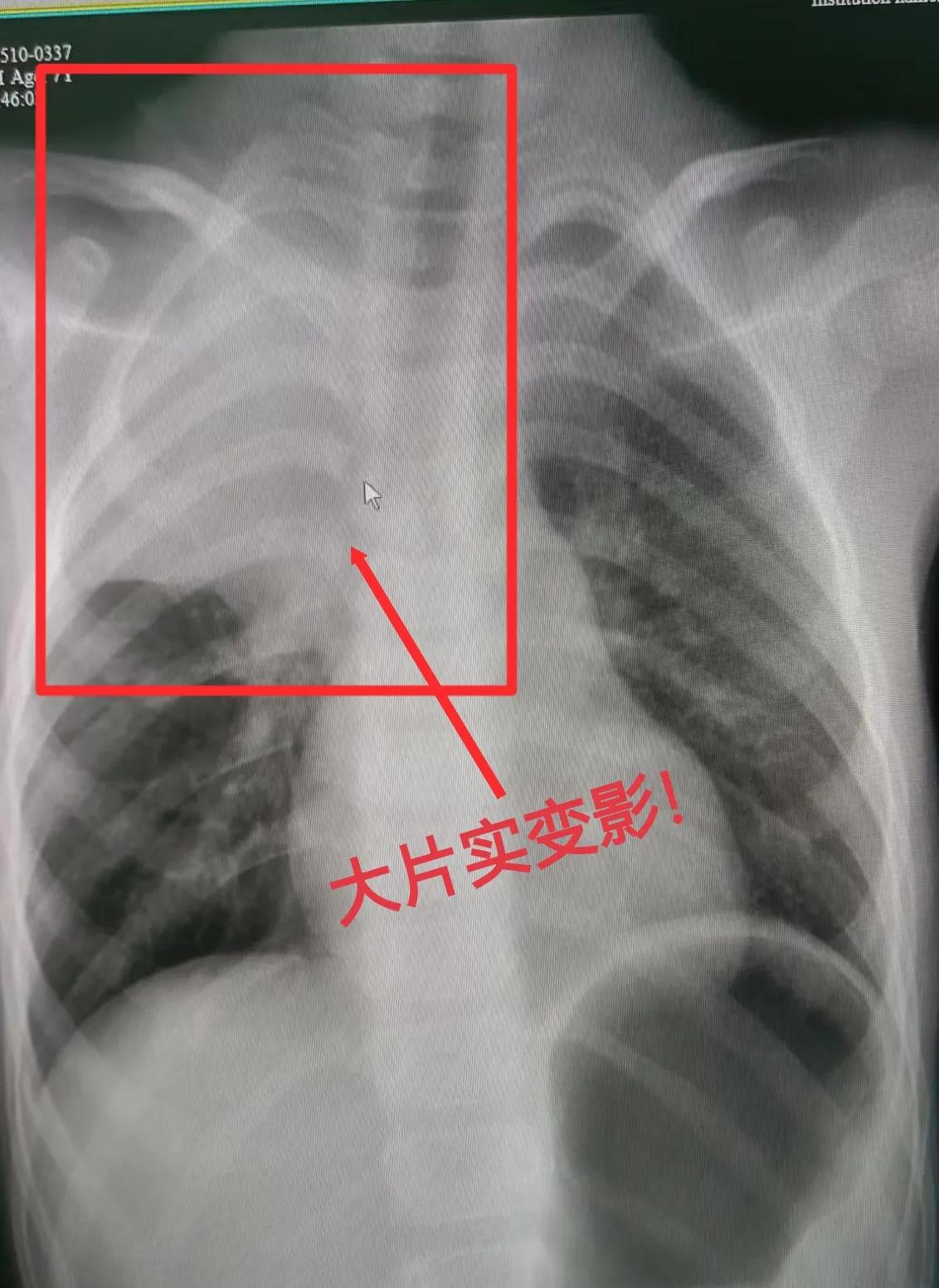 我真是服了某些家长