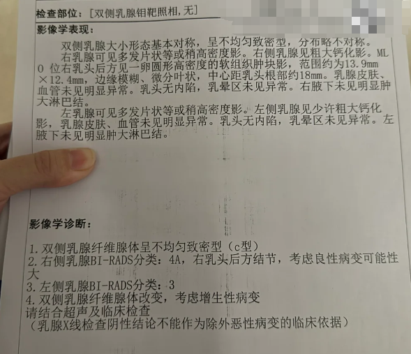 钼靶4a这个结果并不能直接说明乳腺癌是早期还是晚期