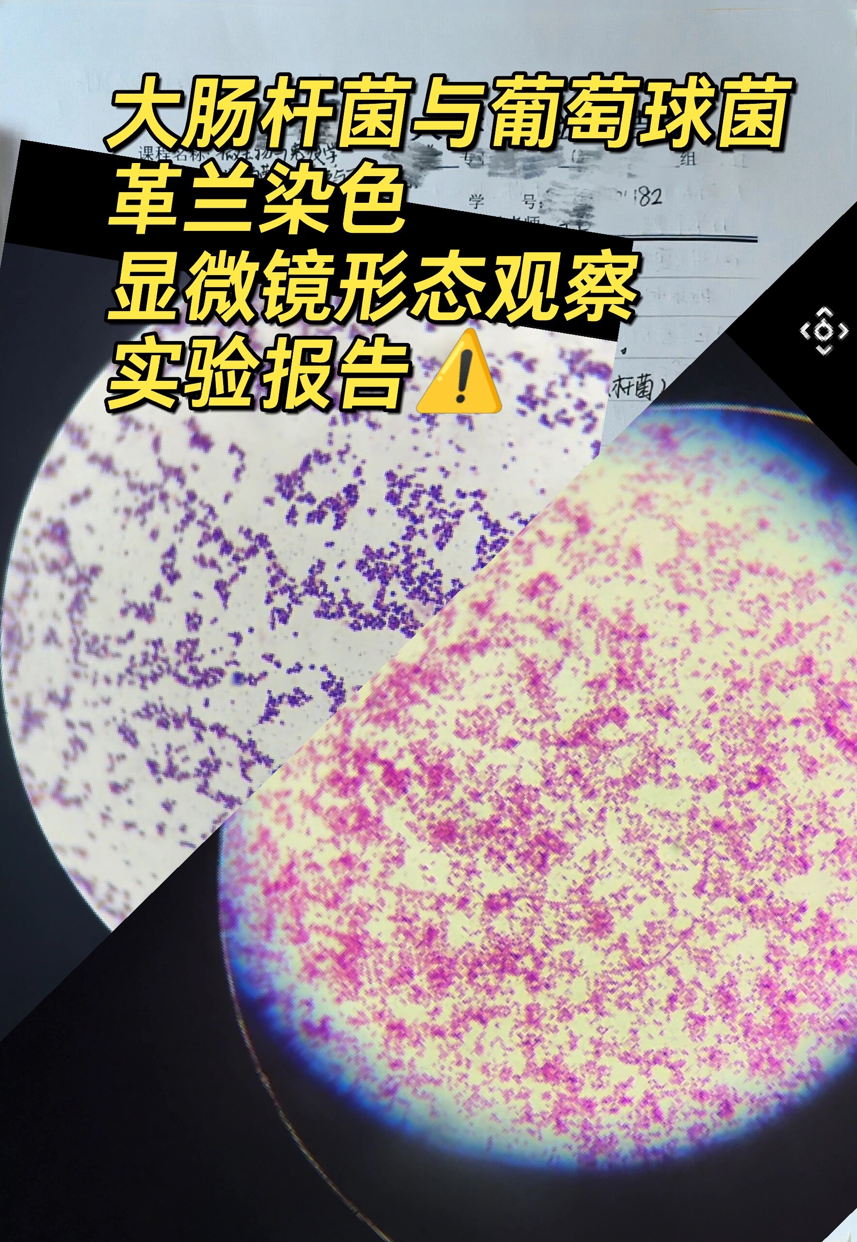 《细菌革兰染色与形态观察》实验报告