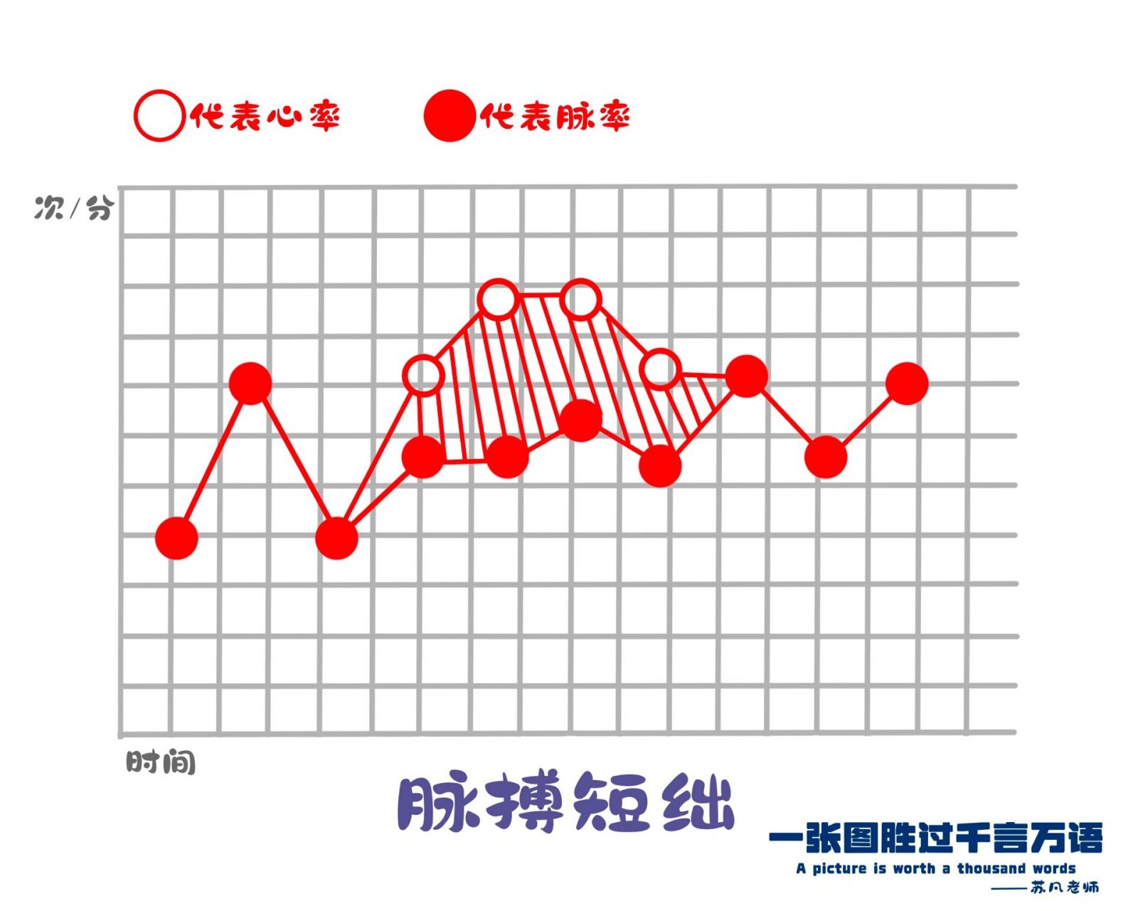 脉搏短绌