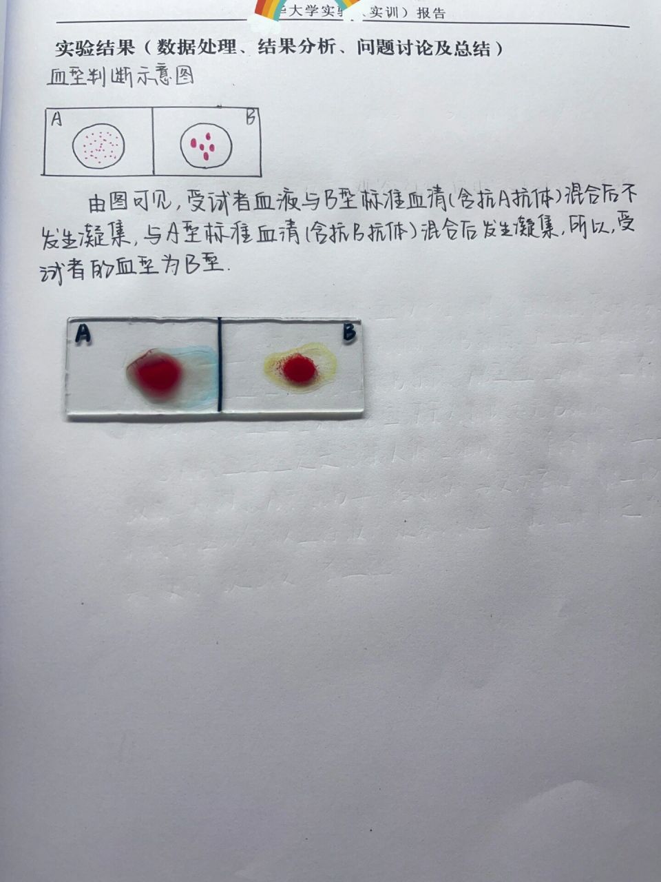 abo血型鉴定实验报告