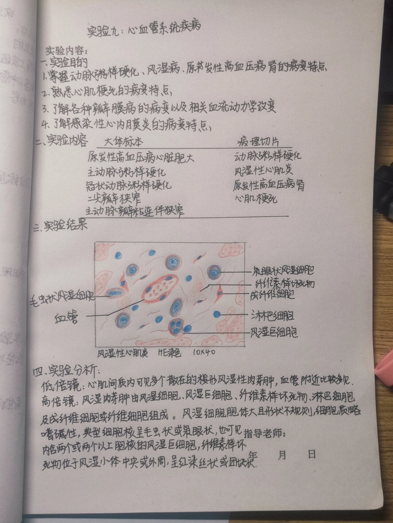 病理实验报告-风湿性心肌炎 红蓝铅笔手绘 心血管系统疾病 重点结构