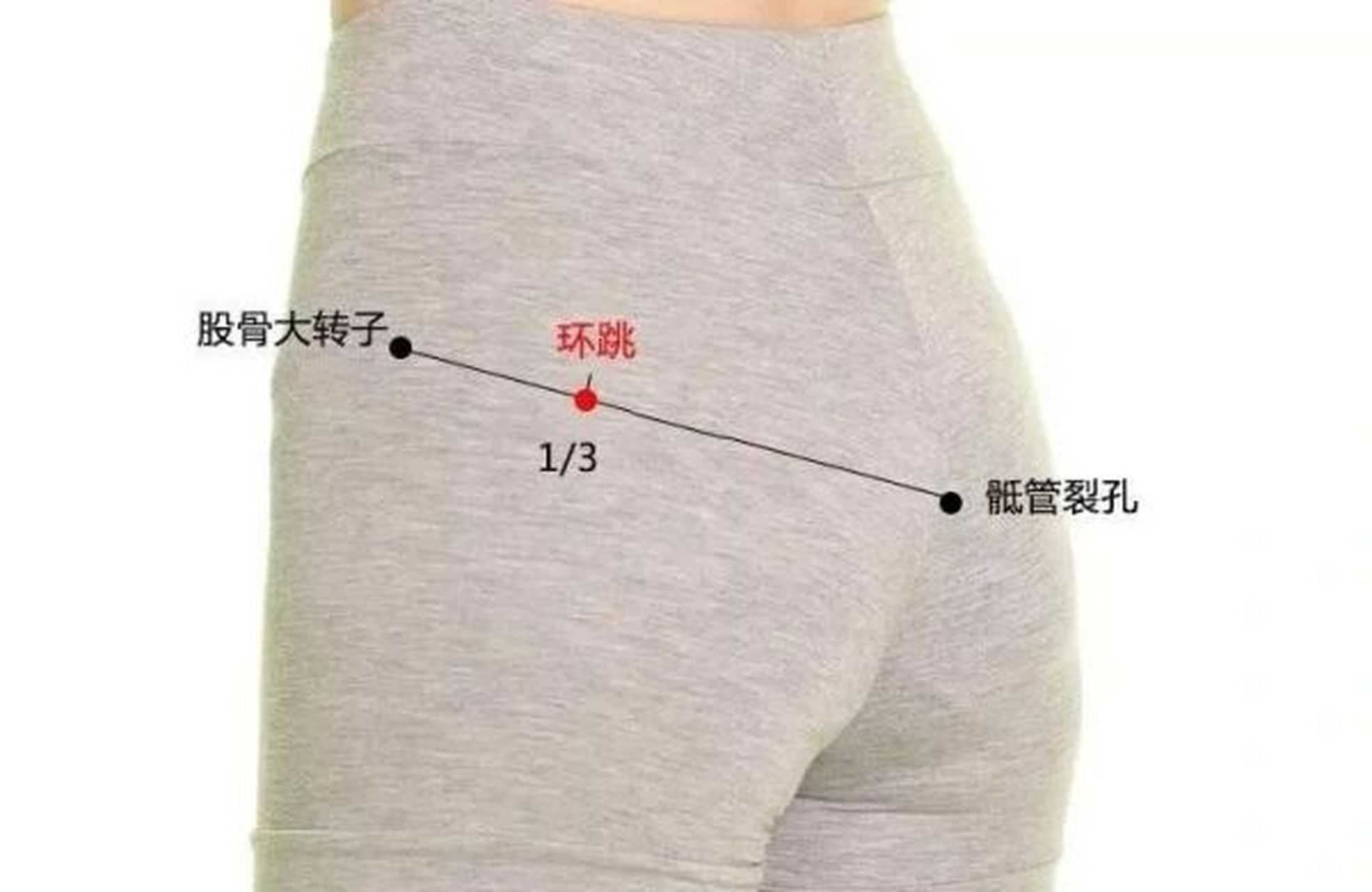 穴位小知识——环跳穴(胆经) 【位置】在臀外侧部,股骨大转子最凸点与