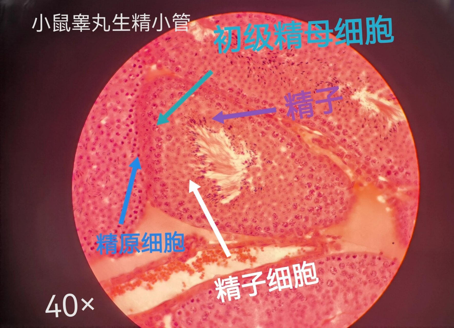 同源染色体 精原细胞图片