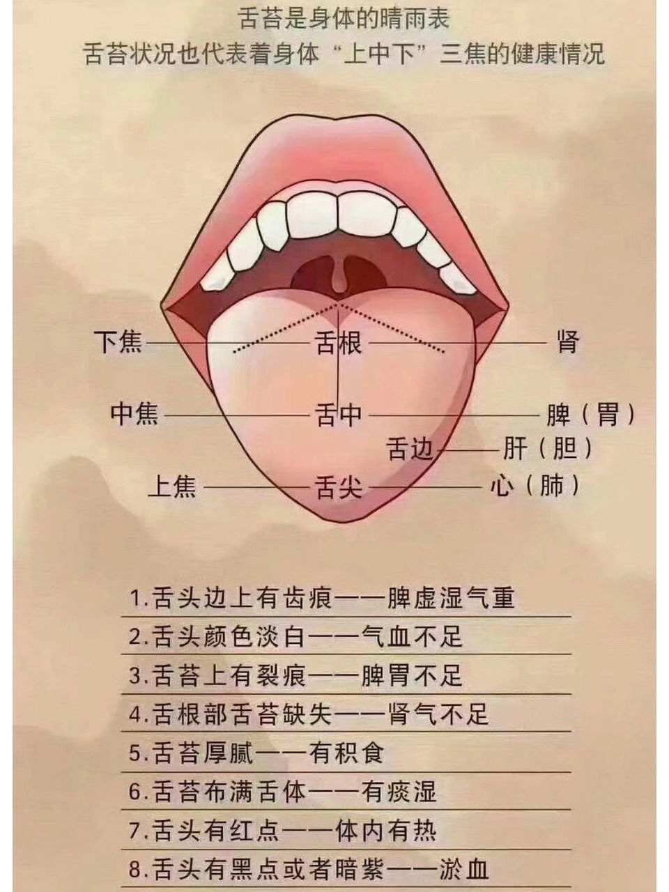 教大家最简单的舌相辨别方法 舌苔由胃气所生,而五脏六腑皆禀气于胃.